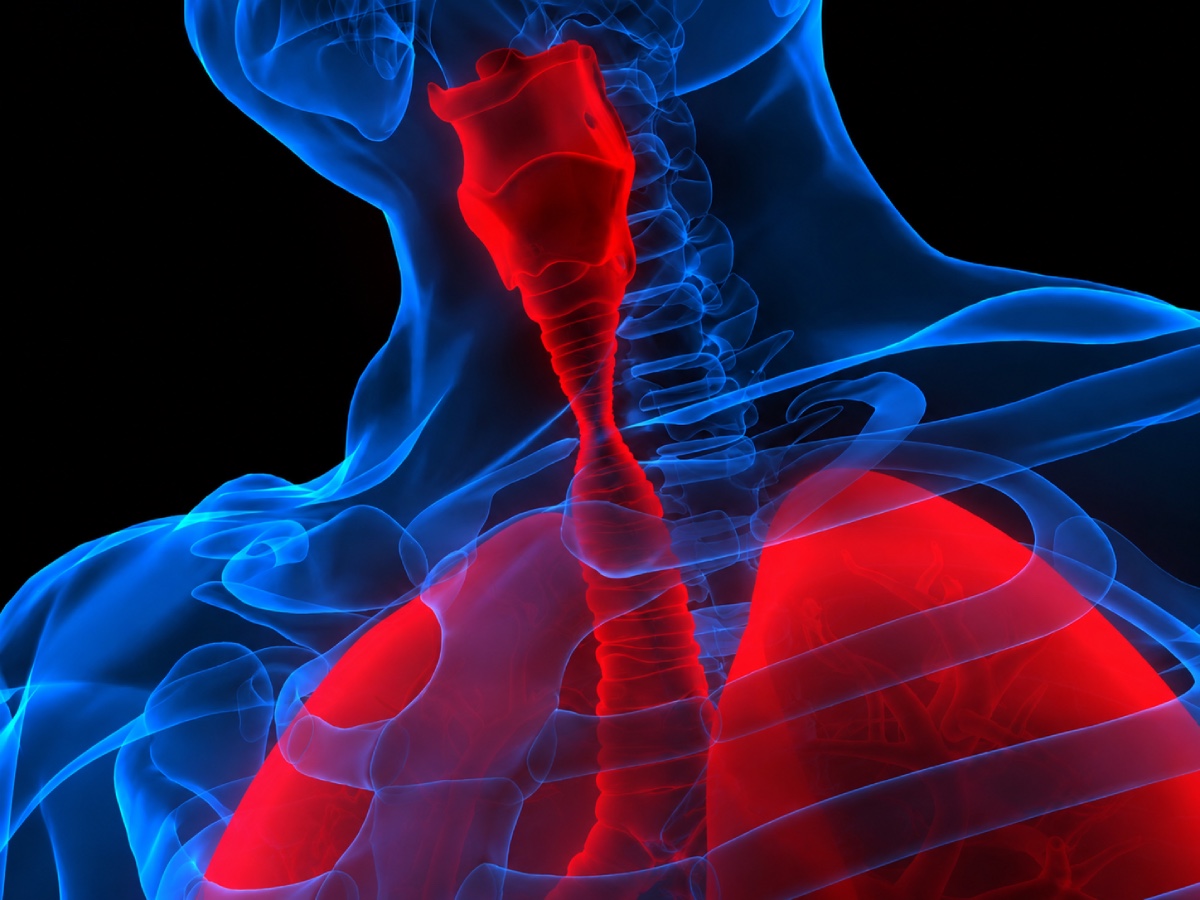 Airway Management for Tracheal Stenosis During General Anesthesia
